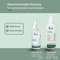 Recommended Product for Acne Prone Normal Skin