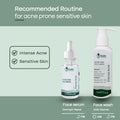 Recommended Product for Acne Prone Sensitive Skin