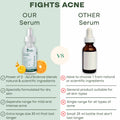 Fights Acne - Our Serum vs Other Serum